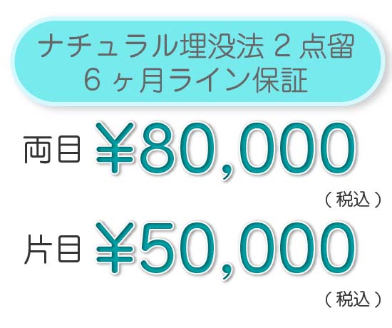 ナチュラル埋没法 2点留 6ヶ月ライン保証 両目 ¥80,000（税込）片目 ¥50,000（税込）